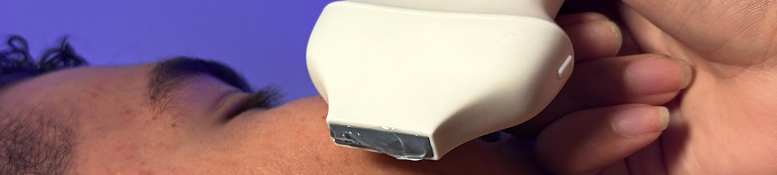 MediExpert Imagen de un médico utilizando ecografía PoCUS para guiar la aplicación de tratamiento estetico