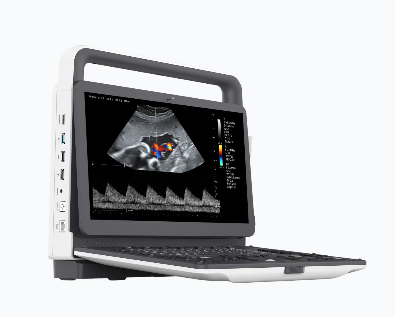 Ultrasonido Portátil con Doppler Color - ME-30 (Para uso veterinario)