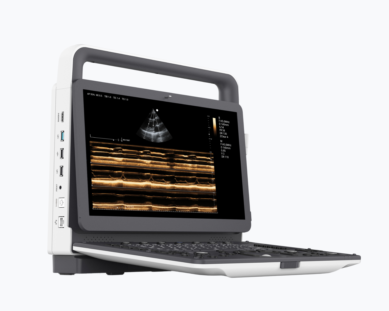 Ultrasonido Portátil con Doppler Color - ME-50