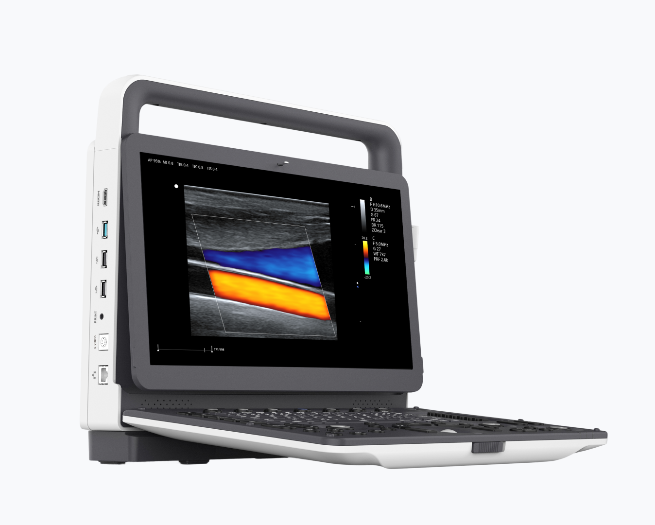 Ultrasonido Portátil con Doppler Color - ME-50