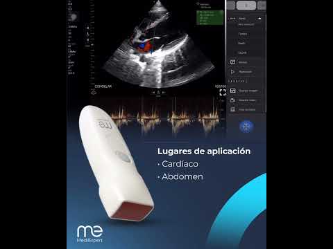 PM4H-CWD – Transductor Phased Array + CWD + Tablet
